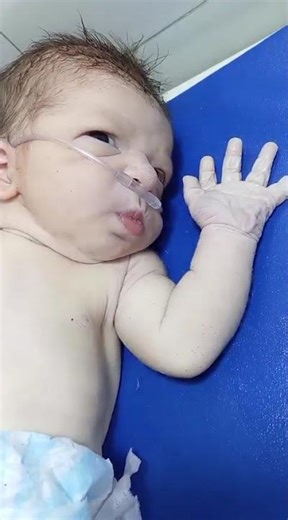 Newborn Oxygen Dependent Baby Care | Safe Handling & Monitoring Tips 👶💙 #baby #baby #newborncare