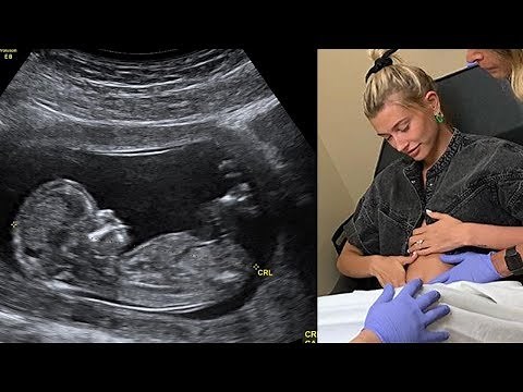 BREAKING: Justin Bieber & Hailey Baldwin Share Pregnancy News!