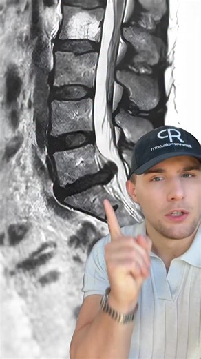 Recover Pain on Reels