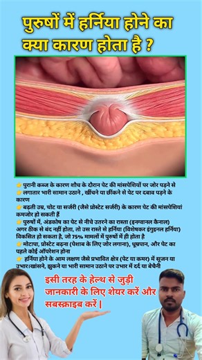 पुरुषों में हर्निया होने का क्या कारण होता है ? Hernia treatment process || #viral #hernia