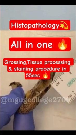 Grossing & Tissue processing in 59sec🔥 ‪@Mgugcollege2709‬ #shortsfeed #histopathology #histopath