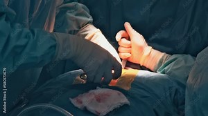 An open heart surgery can only be performed after chest dissection has been performed