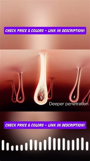 Painless At-Home Laser Hair Removal NNZA IPL Ice Cooling Review