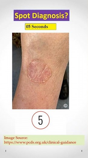 Dermatology Spot Diagnosis Quiz #51. Doctors, check your Clinical Skill