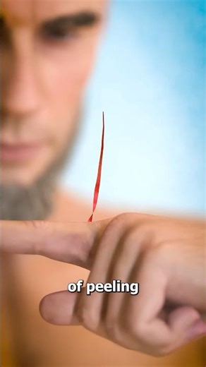 Why You Shouldn't Peel Your Hangnails 😖 Surgeon Reacts