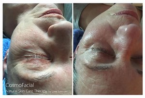 11 shares | CosmoFacial Natural Skin care therapy by Lone Sorensen www.internationalreflexology.com | Facial reflexology, Reflexologia Facial, Ansigtszoneterapi | Facebook