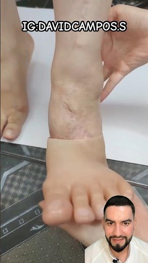 PROTESIS DE PIE COMPLETO