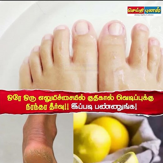 ஒரே ஒரு எலுமிச்சையில் குதிகால் வெடிப்புக்கு நிரந்தர தீர்வு!! இப்படி பண்ணுங்க! Part 3