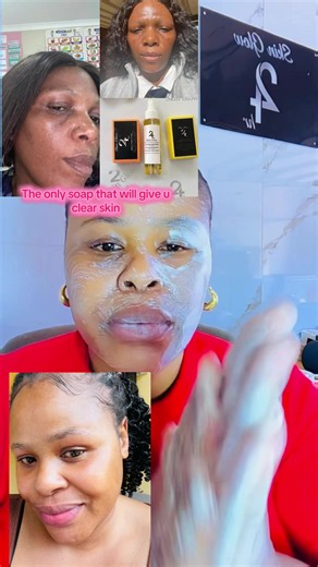 Best Soap for Clear Skin: Acne, Pigmentation & Blemish Treatment