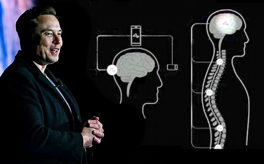 【中文】马斯克发布Neuralink最新进展，计划展开盲人复明和意念控制手机的测试