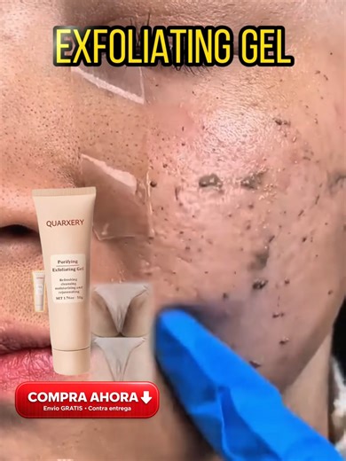 Exfoliante que aclara tu piel desde el primer uso