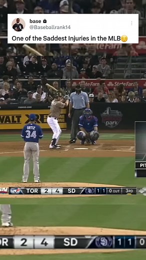 Baseball Player Suffers Devastating Injury on Field