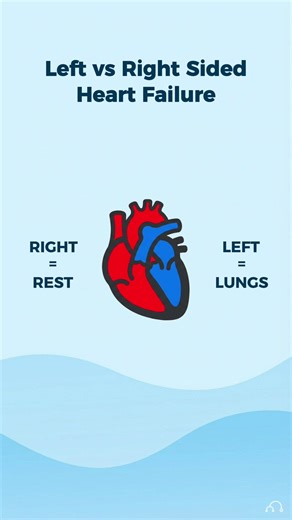 Understanding Left vs Right Side Heart Failure
