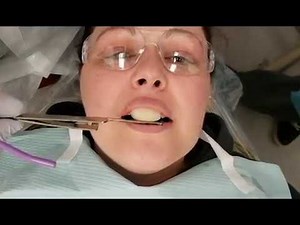 Leaf Guage, Anterior Deprogrammer, and Lucia Jig - 3 more methods to capture CR - Dr. Mark R. Taylor