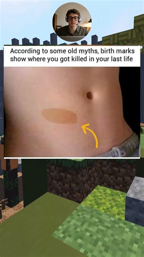 The truth behind birthmarks... 😂 wait for it! #shorts #funny