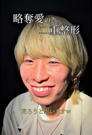 略奪愛の為二重整形 #二重整形 #二重埋没 #TCB #東京中央美容外科 #新宿