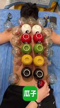 Stress-Free Cupping Therapy: Soothe Your Mind, Body, and Soul