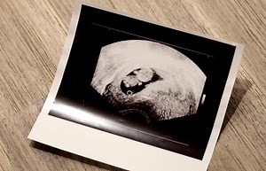 Your 8-Week Pregnancy Ultrasound: What You Can See | LoveToKnow Health & Wellness