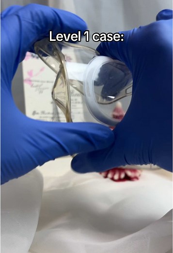 Level 10 case 🔥 #iphonecase #phonecase #iphone #apple