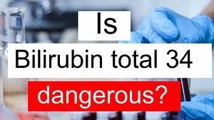 Is Serum Bilirubin total 34 high, normal or dangerous? What does Serum Bilirubin total level 34 mean?