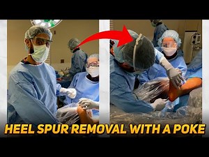 Heel Spur Surgery With a Small Poke!