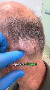 "Doctor, a soft lump has appeared on my scalp... should I be worried?"