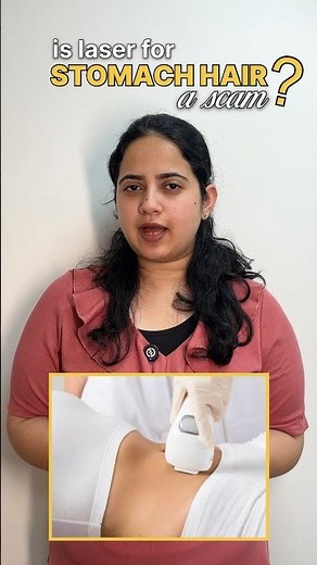 Best way to remove Body Hair | Laser Hair Removal is a scam? | How to Remove Stomach Hair ? | #lhr