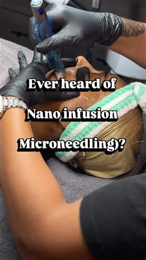 Microneedling + Nano Infusion Explained #microneedling #facial