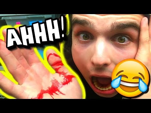 FUNNIEST SNAKE BITES EVER!! | BRIAN BARCZYK