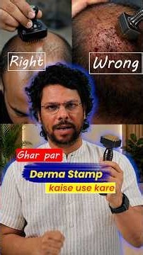 How to use Derma stamp at home !!Hair loss ! Hair fall #waidon #viral #shorts