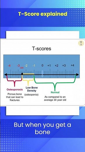 T-Score Explained