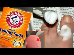 How To Remove a Splinter With Baking Soda | Happy Life