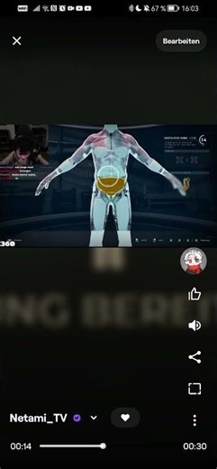 Ups... Falsches Organ #netami