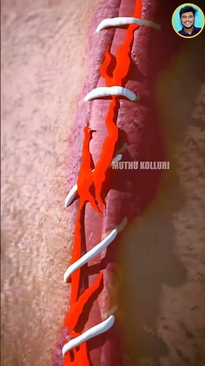 How Stitches Work 😯