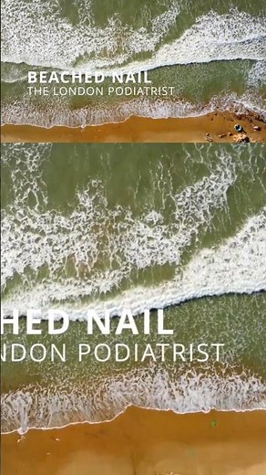 Removing a Damaged Big Toenail After a Beach Rock Injury! 🦶⚕️ | Foot Health Explained