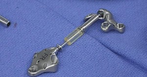 A look at cutting-edge knee tech at UC Davis Health