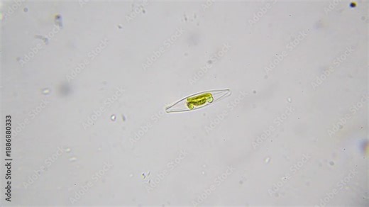 Live diatom algae with clearly visible structure under 2000x brightfield microscopy using immersion oil. Detailed 4k microscopic view of unicellular algae