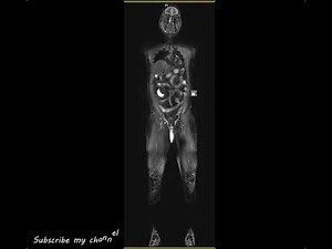 3 Tesla WHOLE BODY MRI