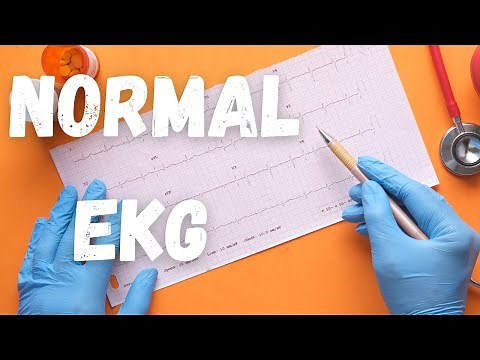 The characteristics of Normal EKG or ECG