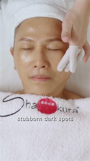 “I Thought My Dark Spots Were Forever.” – Anna, 62, Shares Her Honest SHAKURA Review 🥺👉🧡