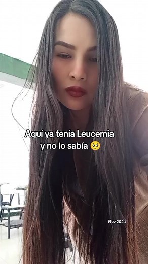 Síntomas de Leucemia: Mi Experiencia Personal