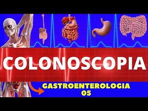 Colonoscopy (How the exam is performed, what it's for, preparation, and treatment) - Gastroentero...