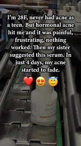 50K views | 珞 When all else fails, Vilvah's Milk Drops Brightening Serum has your back with  results. Beginner-Friendly | Safe For Acne-Prone Skin | Dermat-Approved Formulated with pure Rice Milk & Alpha Arbutin, this lightweight serum reduces dark spots & treats hyperpigmentation. Add to your cart right away! | Vilvah store | Facebook