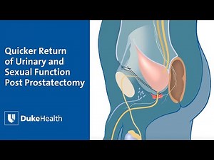 Prostatectomy:A Quicker Return of Urinary and Sexual Function | Duke Health