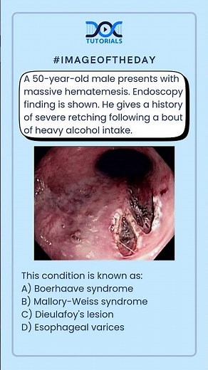 This condition is known as: