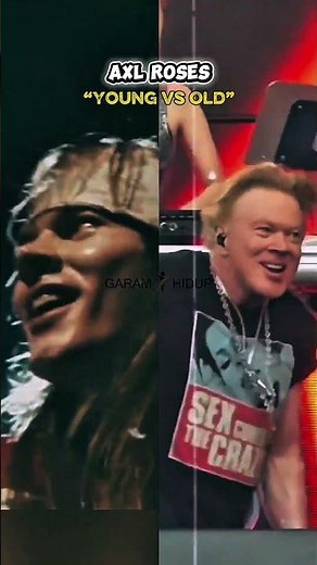 Axl Rose Then vs Now 😱 The Shocking Transformation of a Rock Legend!