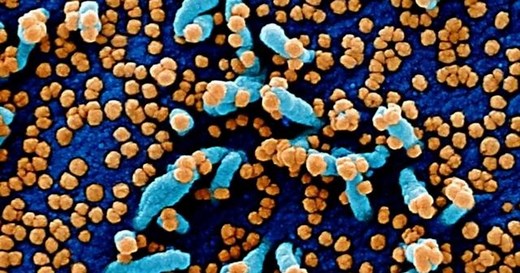 Delta variant dominates new infections as Omicron strain spreads across U.S.