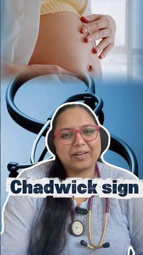 Your Body’s Hidden Pregnancy Signal — Chadwick’s Sign 💙 #pregnancy #shorts #yourgynac