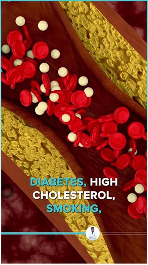 Erectile Dysfunction & Heart Disease Link Explained | Dr Rohit Kaushal