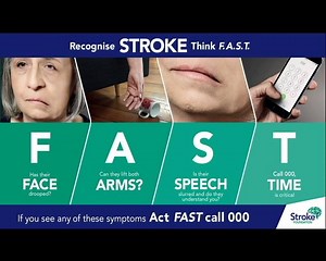 Our paramedics, nurses and doctors know that every minute counts when treating stroke. But they can only do their job if you do yours. Simply by taking a minute to learn the signs of stroke, you become part of the FAST Response Team. You could save a life. | Stroke Foundation